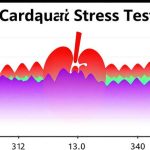 Перевод протокола кардиологического стресс-теста с нагрузкой на беговой дорожке
